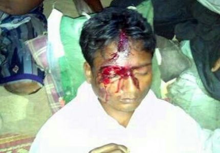 Rakhine Terrorists Brutally Beat Up a Rohingya Youth